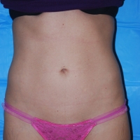 10body-001