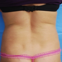 12body-004