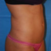 13body-007