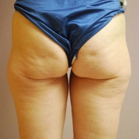 vella-big-after